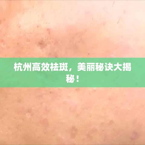 杭州高效祛斑，美麗秘訣大揭秘！