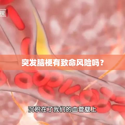 突發(fā)腦梗有致命風(fēng)險(xiǎn)嗎？