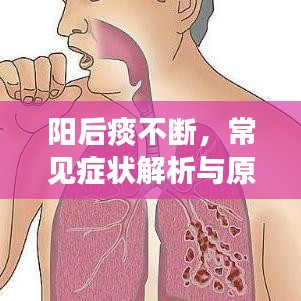 陽后痰不斷，常見癥狀解析與原因探究