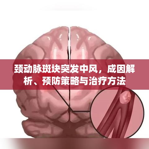 頸動脈斑塊突發(fā)中風，成因解析、預(yù)防策略與治療方法